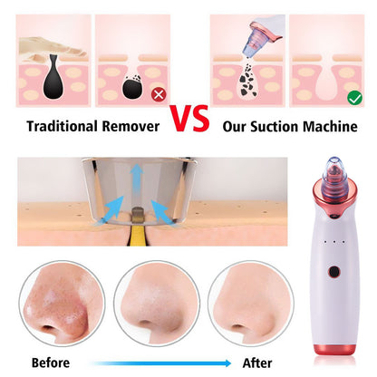 Electric Acne & Blackhead Remover – USB Rechargeable Skin Care Device